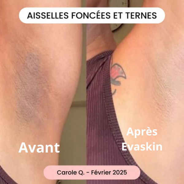 Les résultats parlent d'elle m'aimes 👌🏾!