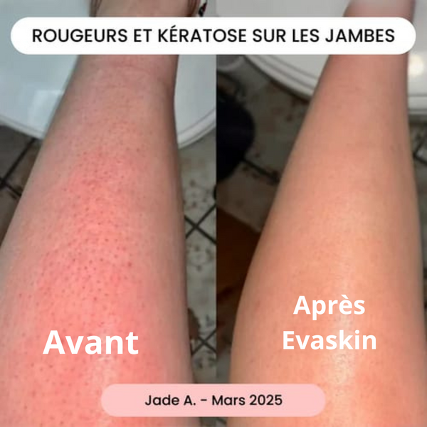 Evaskin lifestyle